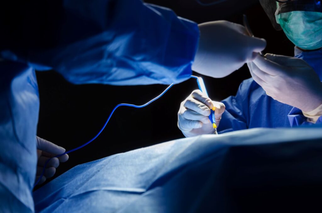 Close nas mãos de médicos realizam cirurgia para hiperplasia benigna da próstata