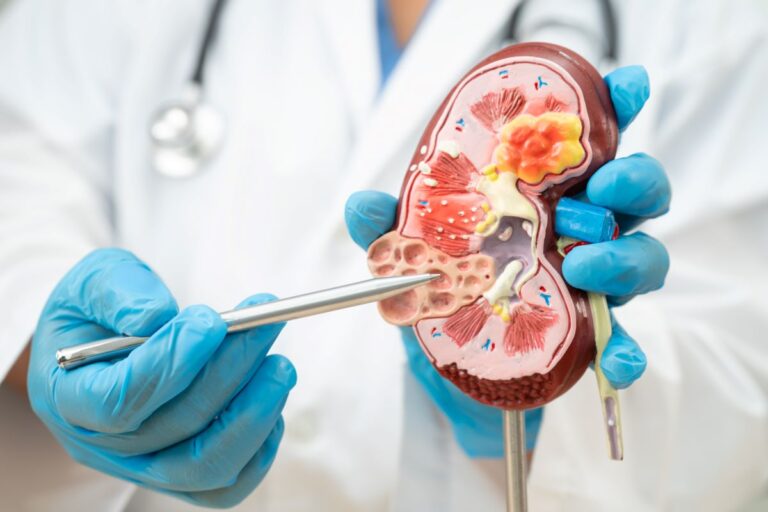 O que é câncer de rim? Médico faz recorte em representação de rim para mostrar estruturas do órgão