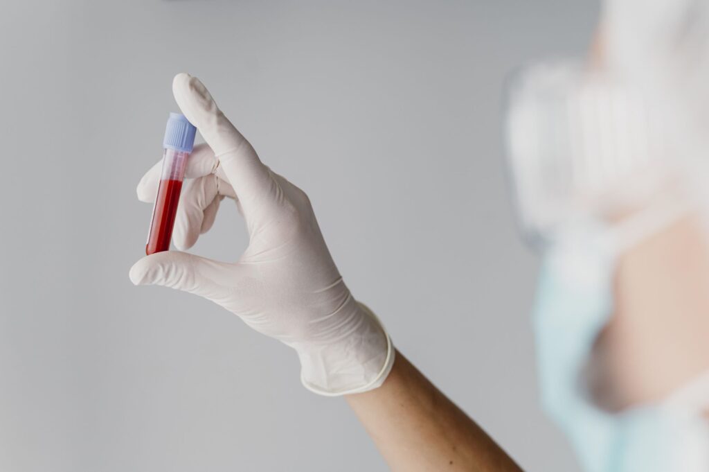 Mão enluvada segura tubo de ensaio com sangue. É importante entender a tabela de PSA por idade