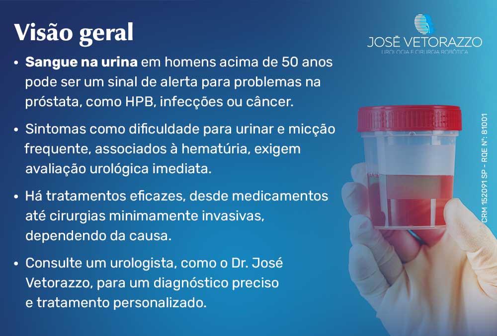 Visão geral sobre o sangue na urina
Sangue na urina em homens acima de 50 anos pode ser um sinal de alerta para problemas na próstata, como HPB, infecções ou câncer.
Sintomas como dificuldade para urinar e micção frequente, associados à hematúria, exigem avaliação urológica imediata.
Há tratamentos eficazes, desde medicamentos até cirurgias minimamente invasivas, dependendo da causa.
Consulte um urologista, como o Dr. José Vetorazzo, para um diagnóstico preciso e tratamento personalizado.
