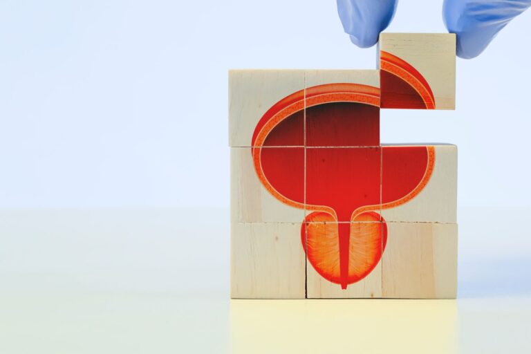 Representação anatômica da próstata montada com blocos de madeira, simbolizando o diagnóstico por etapas de condições como a calcificação da próstata.