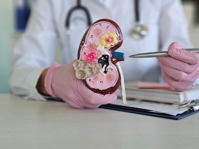 Médico mostra modelo de rim com cisto de Bosniak, explicando a formação e classificação da lesão renal em ambiente clínico.